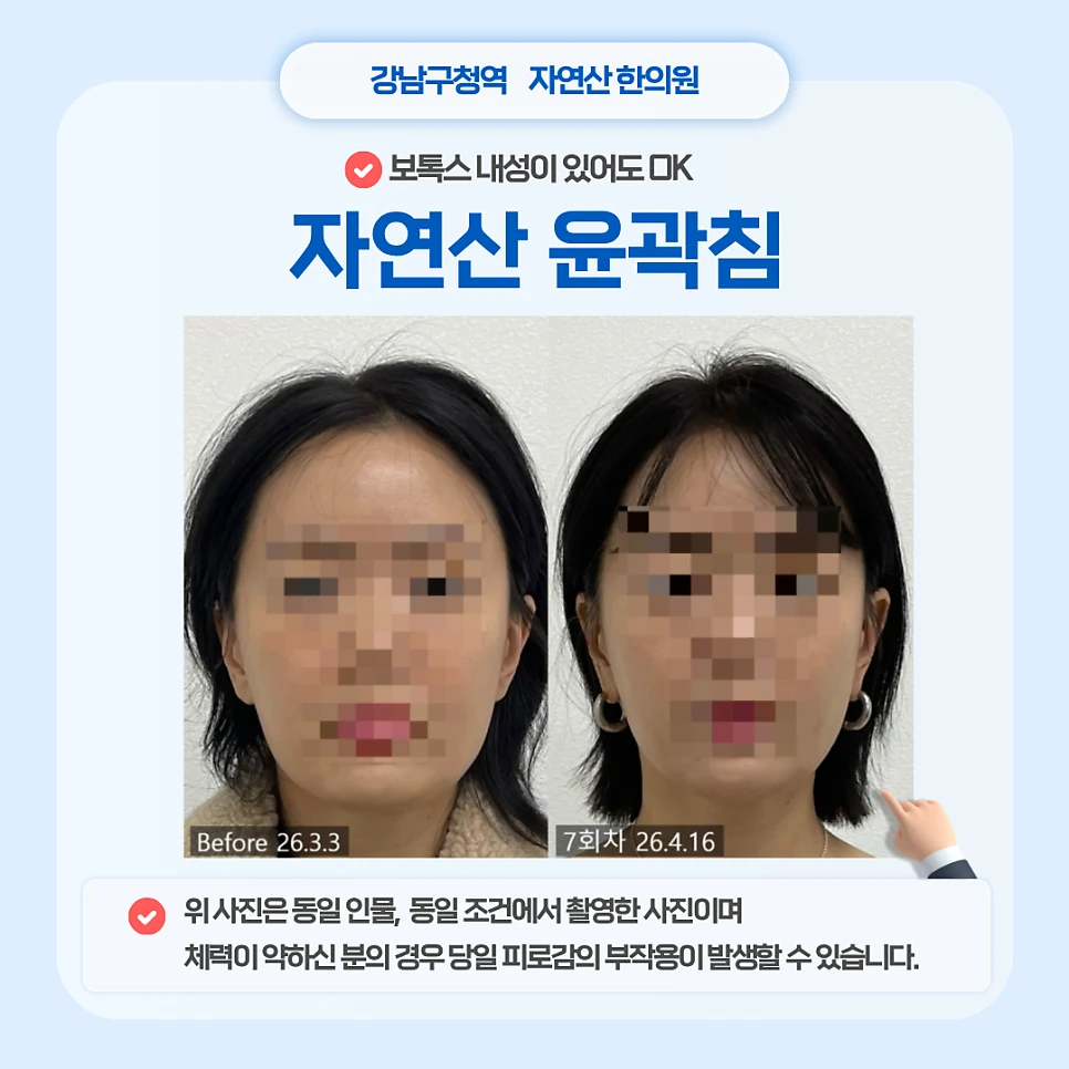 윤곽 관리 전후사진 1