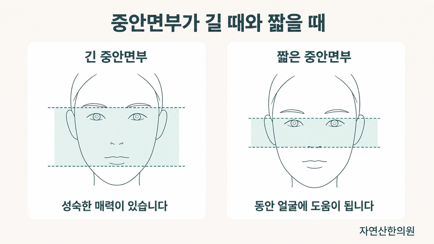 중안면부가 긴 얼굴과 짧은 얼굴을 나란히 놓고 얼굴형 차이점을 표시한 비교 도해