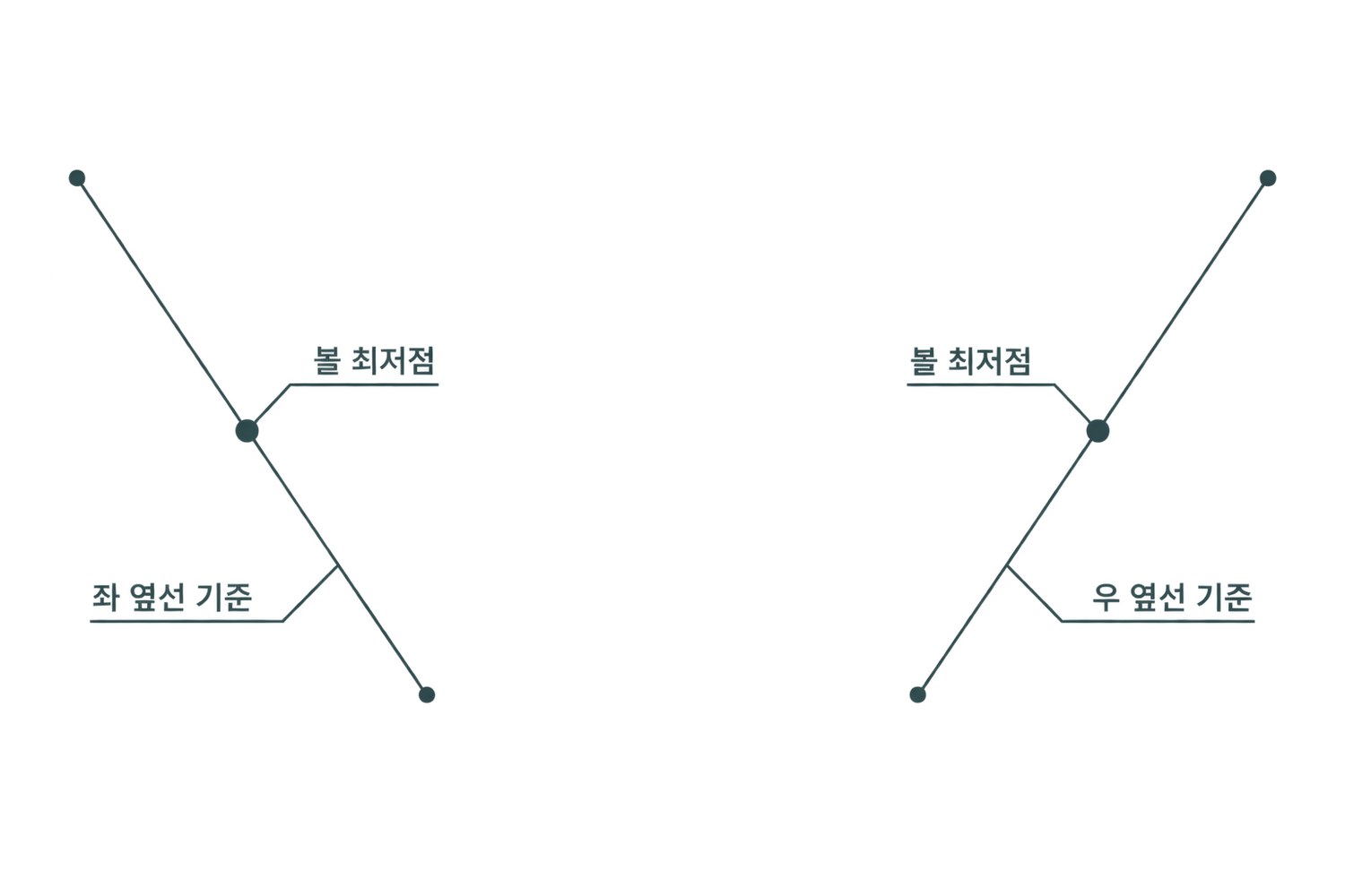 전후 사진 위에 얹는 좌·우 옆선 기준 사선과 볼에서 가장 꺼진 최저점을 표시한 오버레이 도해