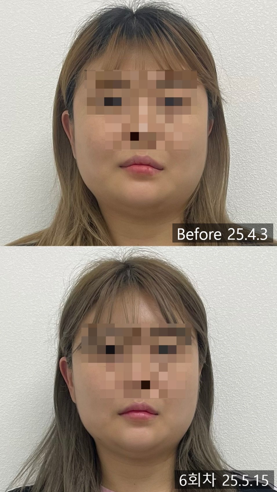 교정 전과 6회차 상하 배치 비교 — 보정 없는 원본