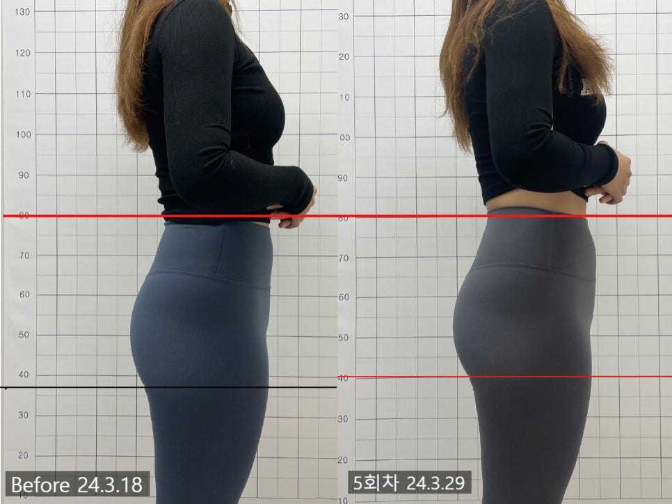 허리 잘록한 지점과 엉덩이·허벅지 경계에 기준선을 얹은 5회차 전후 비교 — 보정 없는 원본