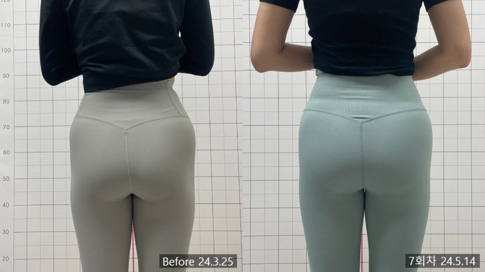 중둔근 발달침 7회차 후면 전후 비교 — 동일 인물·동일 조건에서 촬영한 보정 없는 원본