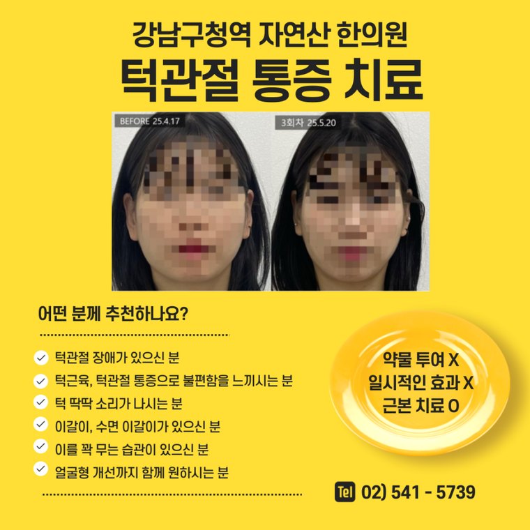 tmj-pain-treatment 치료 사례 5 — 시술 전후 비교