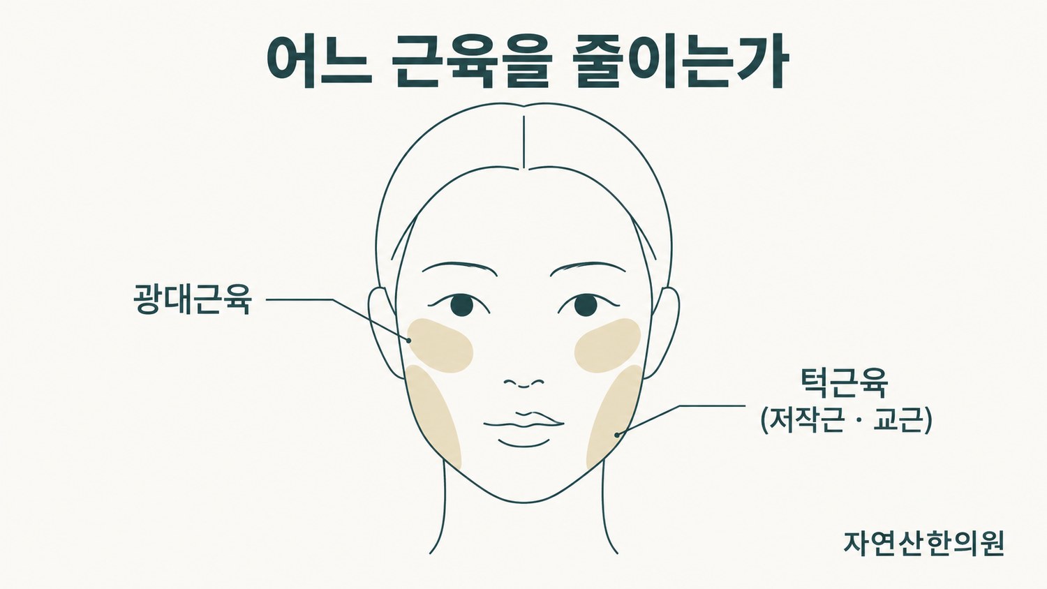 광대근육과 턱근육(저작근·교근)의 위치를 얼굴 도해 위에 표시한 그림