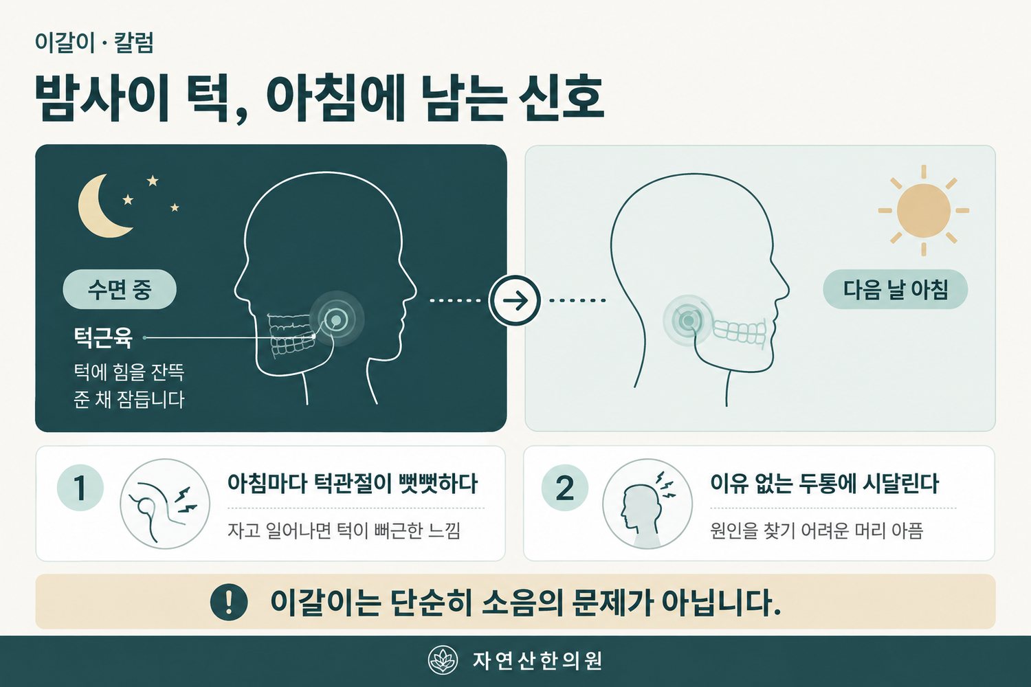 과발달한 턱근육이 턱관절 통증·수면 이갈이·이를 꽉 무는 습관·턱 딱딱 소리로 이어지는 인과 도해