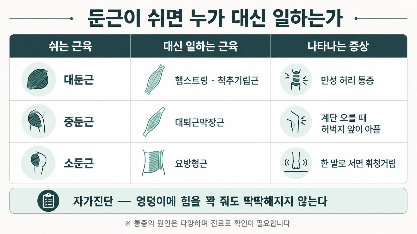 대둔근·중둔근·소둔근이 쉴 때 각각 어떤 근육이 보상하고 어떤 증상이 나타나는지 정리한 3열 표 도해