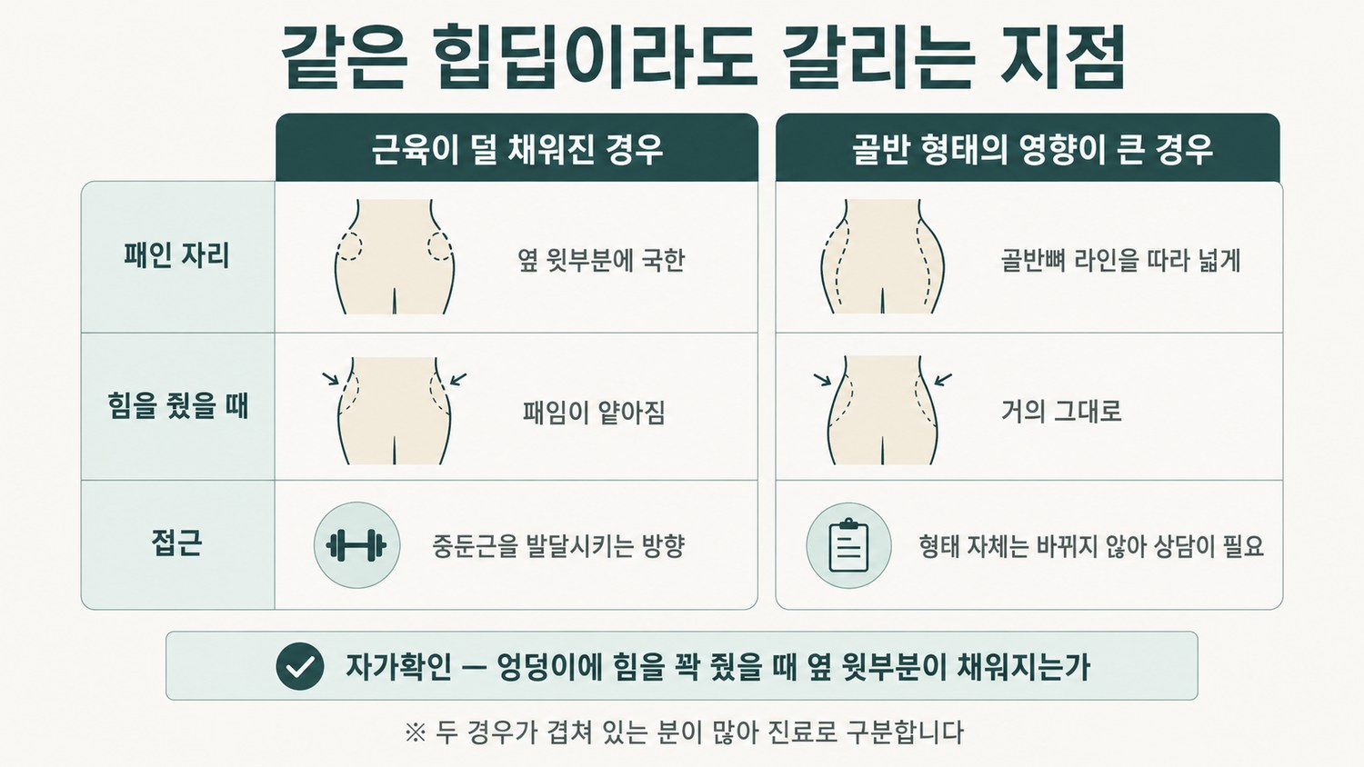 중둔근이 덜 채워진 경우와 골반 형태의 영향이 큰 경우를 나누어 각각의 신호와 확인 방법을 정리한 판단기준 도해