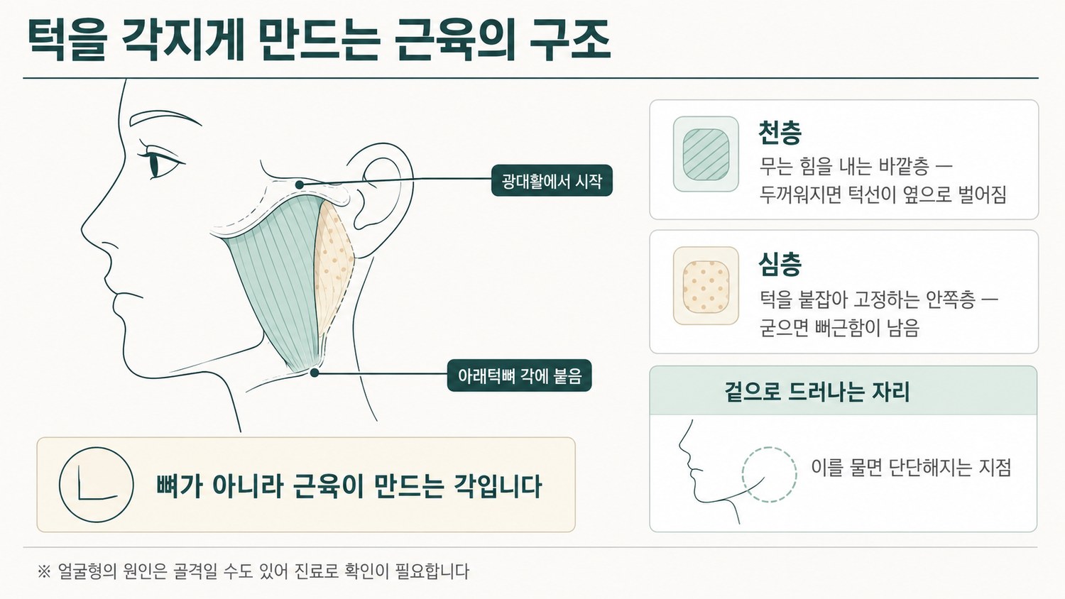 교근 천층과 심층이 광대뼈에서 아래턱뼈로 이어지는 주행과 겉으로 만져지는 자리를 표시한 해부 도해