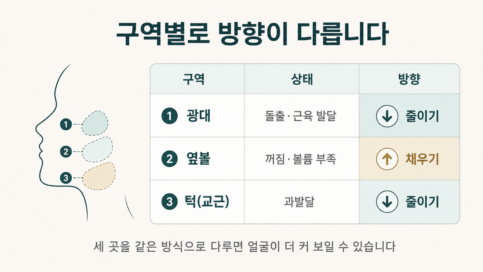 광대·옆볼·턱 세 구역의 상태와 처치 방향을 정리한 비교표 도해