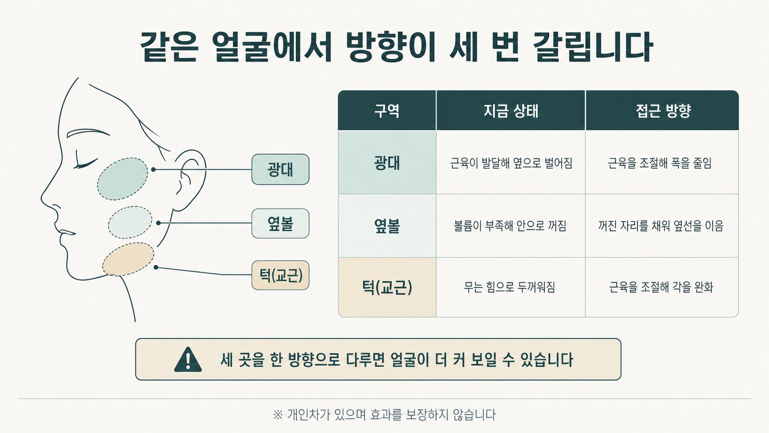 광대·옆볼·턱 세 구역을 왼쪽 열에 두고 각 구역의 지금 상태와 접근 방향을 나란히 정리한 3열 표 도해