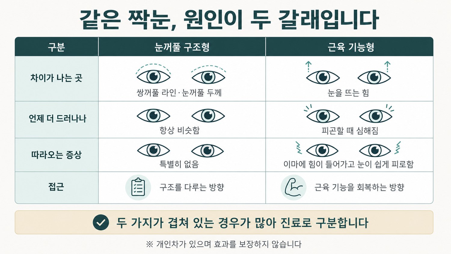 눈꺼풀 구조형 짝눈과 근육 기능형 짝눈을 구분 기준·겉으로 보이는 모습·맞는 접근 3열로 비교한 표 도해