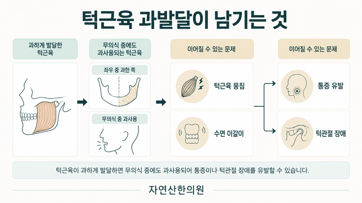 과하게 발달한 턱근육이 무의식 중 과사용으로 이어져 턱근육 뭉침·수면 이갈이, 그리고 통증 유발·턱관절 장애로 이어지는 도해