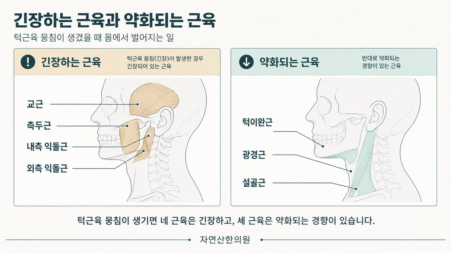 턱근육 뭉침 때 긴장하는 교근·측두근·내측 익돌근·외측 익돌근과 약화되는 턱이완근·광경근·설골근 대비 도해