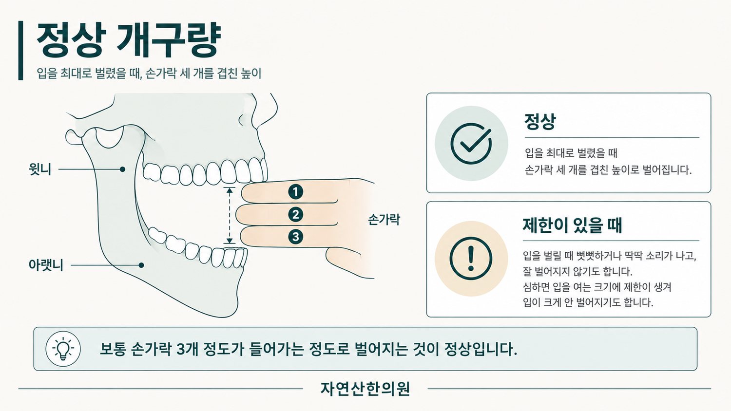 정상 개구량 측정법 도해 — 입을 최대로 벌렸을 때 손가락 세 개를 겹친 높이