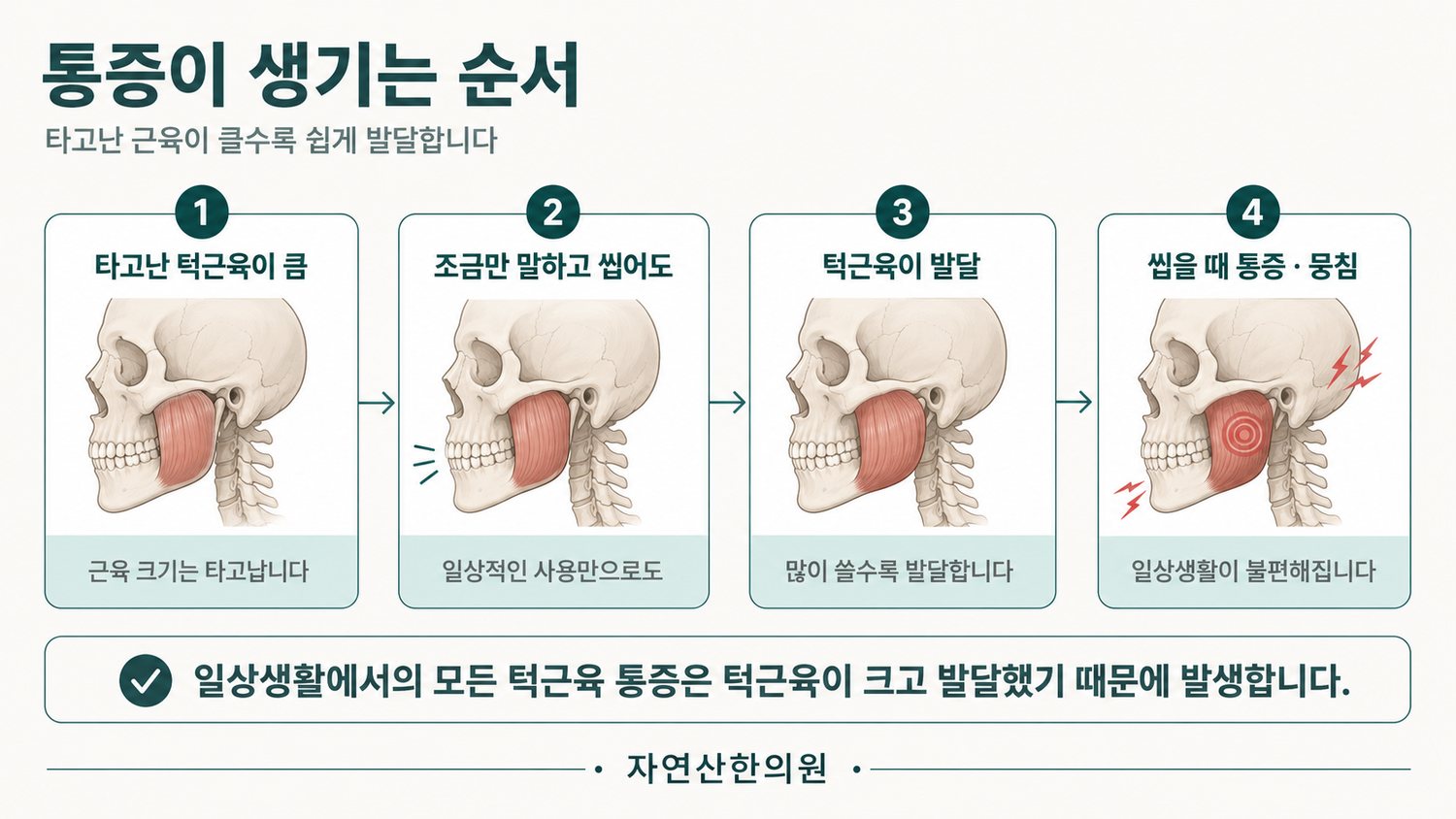 타고난 턱근육이 클수록 조금만 써도 발달해 씹을 때 통증과 뭉침이 생기는 흐름 도해