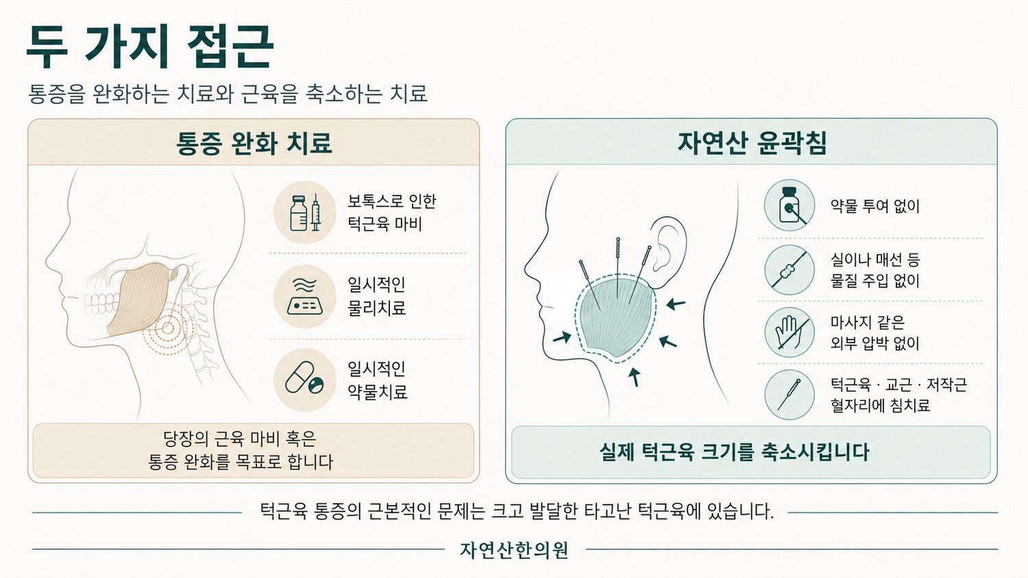 통증 완화 치료와 턱근육 축소를 목표로 하는 자연산 윤곽침 비교 도해