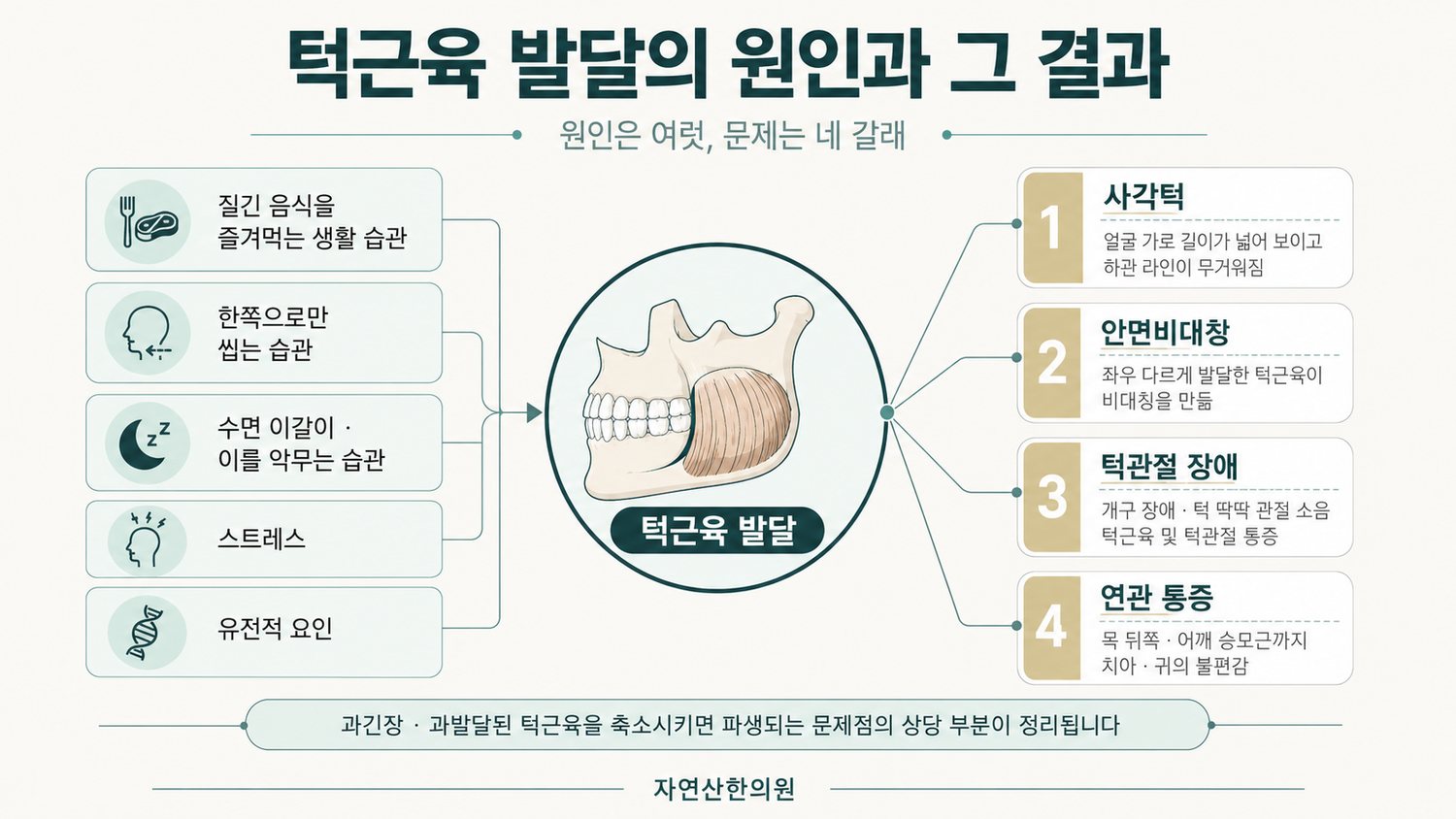 턱근육 발달의 원인들이 턱근육 발달로 모이고 사각턱, 안면비대칭, 턱관절 장애, 연관 통증 네 가지 문제로 갈라지는 다이어그램