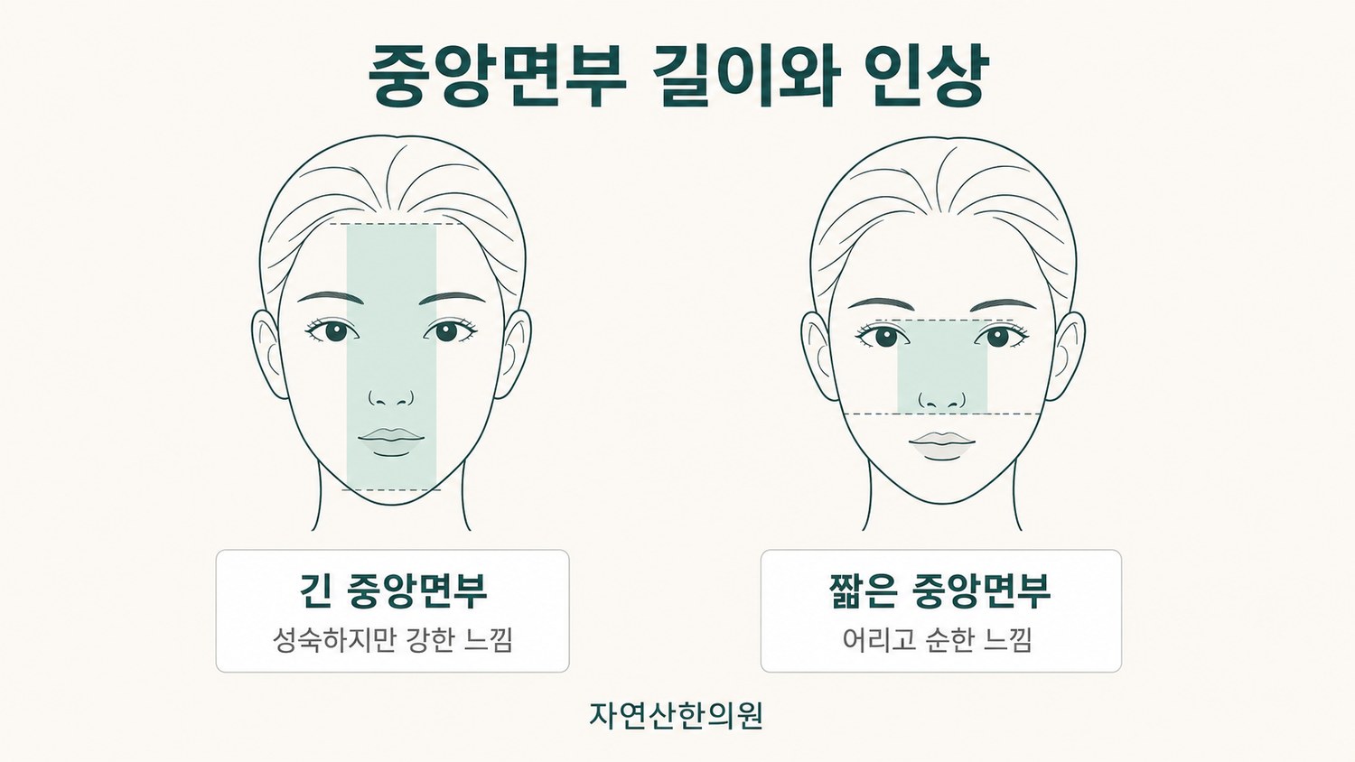 긴 중앙면부와 짧은 중앙면부가 주는 인상 차이를 좌우로 비교한 도해