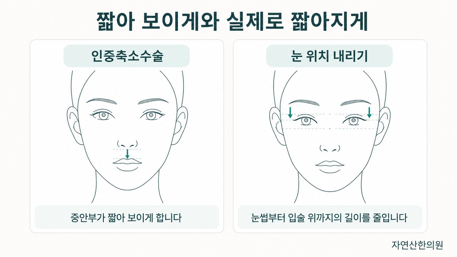 사자와 고양이의 얼굴을 나란히 놓고 중안부 구간 길이 차이를 표시한 비교 도해