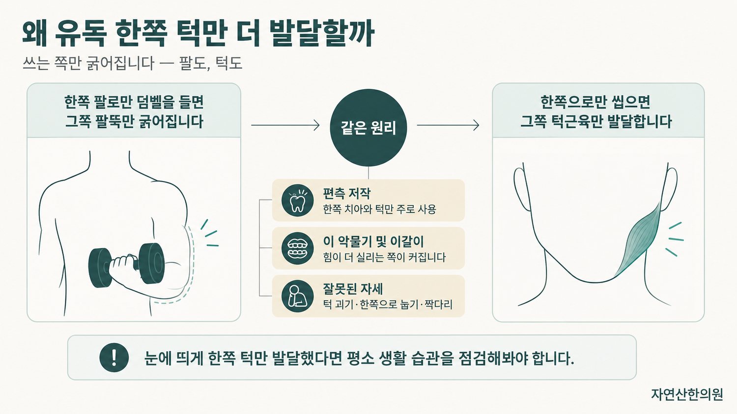 한쪽 팔로만 덤벨을 드는 비유와 편측 저작으로 한쪽 턱근육만 발달하는 모습을 비교한 도해