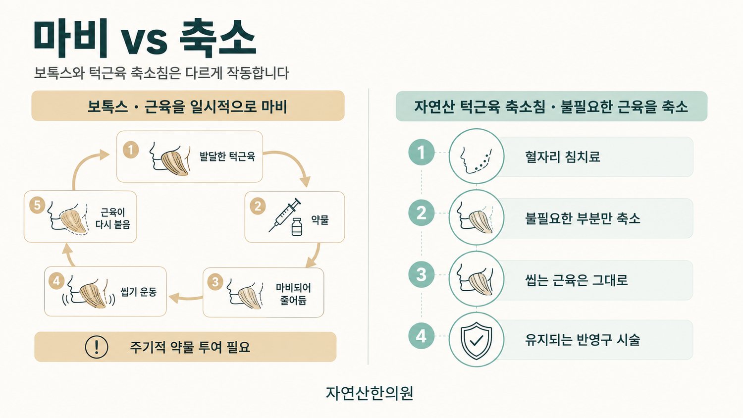 수면 중 이갈이가 치아 마모·턱관절 변형·얼굴형 변화와 사각턱으로 이어지는 진행 경로 도해