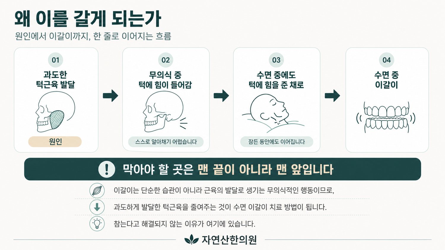 과도한 턱근육 발달이 무의식 중 턱에 힘을 주는 습관을 거쳐 수면 이갈이로 이어지는 메커니즘 도해