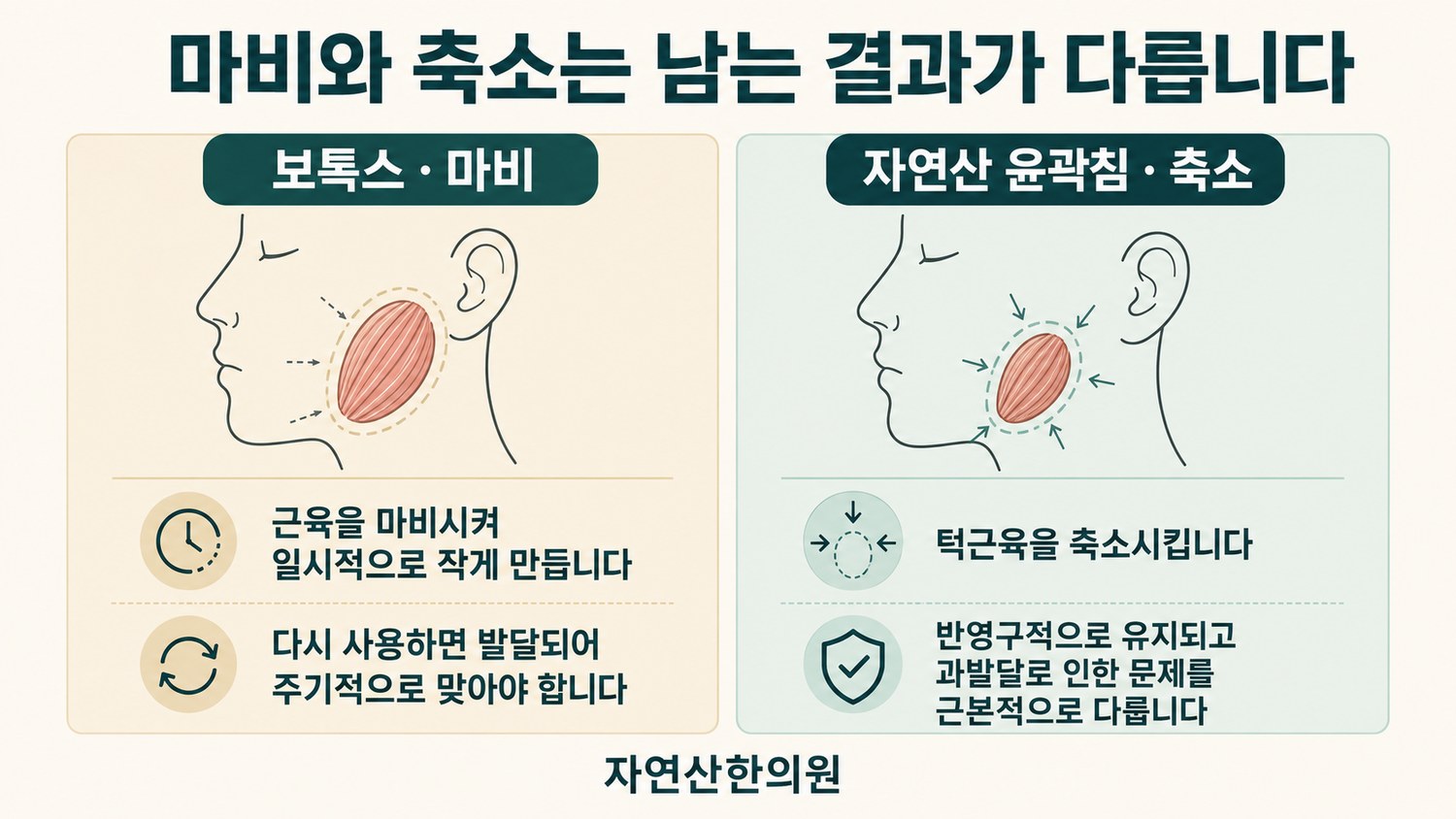 보톡스의 마비 방식과 자연산 윤곽침의 축소 방식을 나란히 비교한 도해