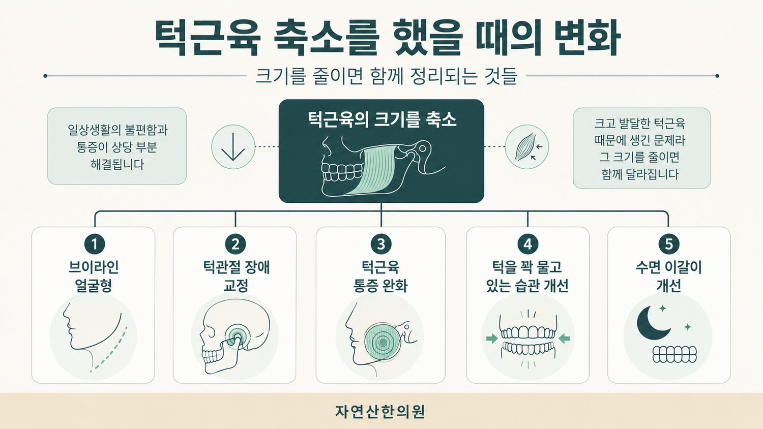 턱근육을 축소했을 때 함께 나타나는 다섯 가지 변화인 브이라인 얼굴형, 턱관절 장애 교정, 턱근육 통증 완화, 턱을 꽉 무는 습관 개선, 수면 이갈이 개선을 정리한 도해