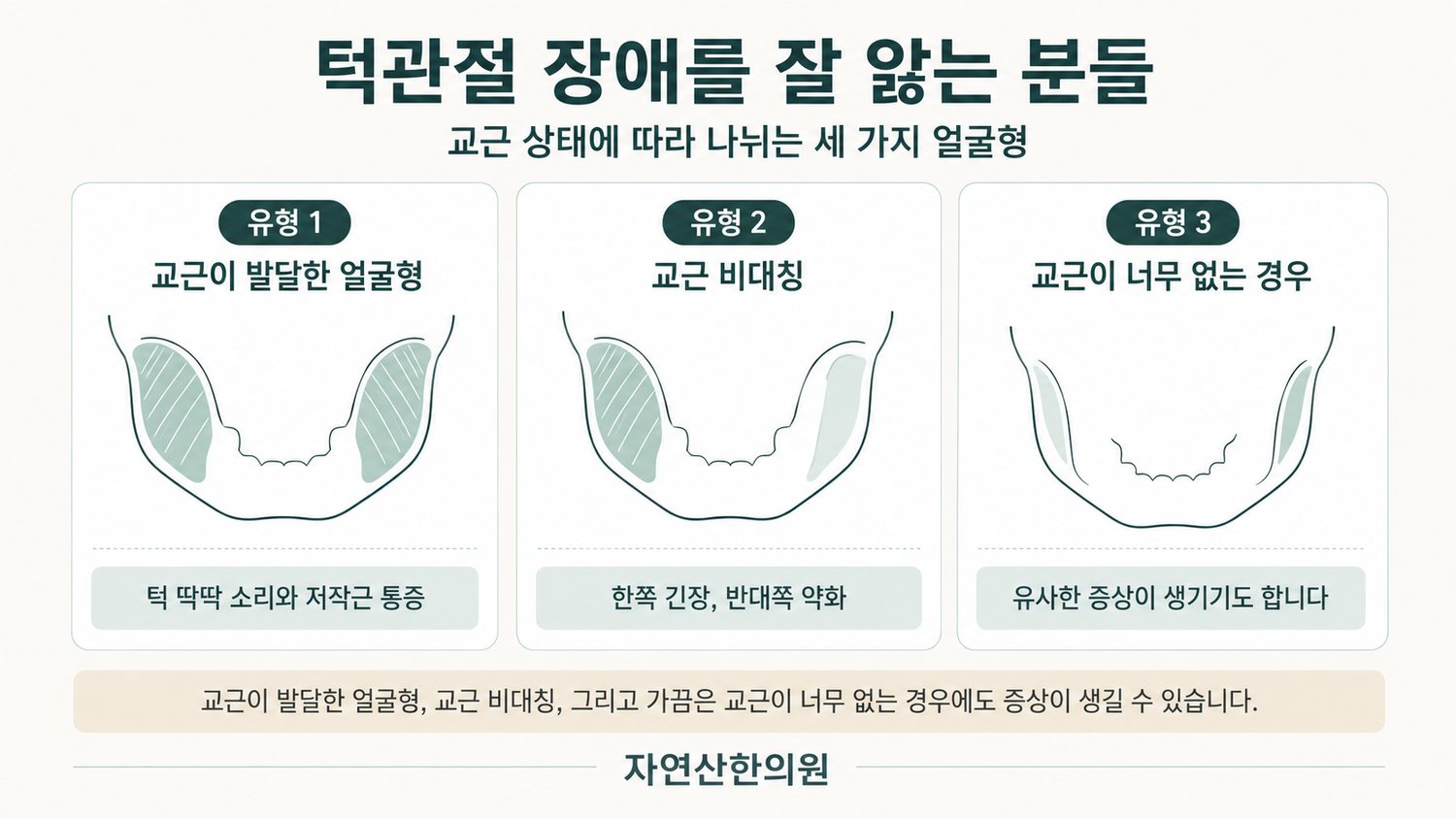 교근이 발달한 얼굴형, 교근 비대칭, 교근이 너무 없는 경우를 나란히 비교한 얼굴 도해