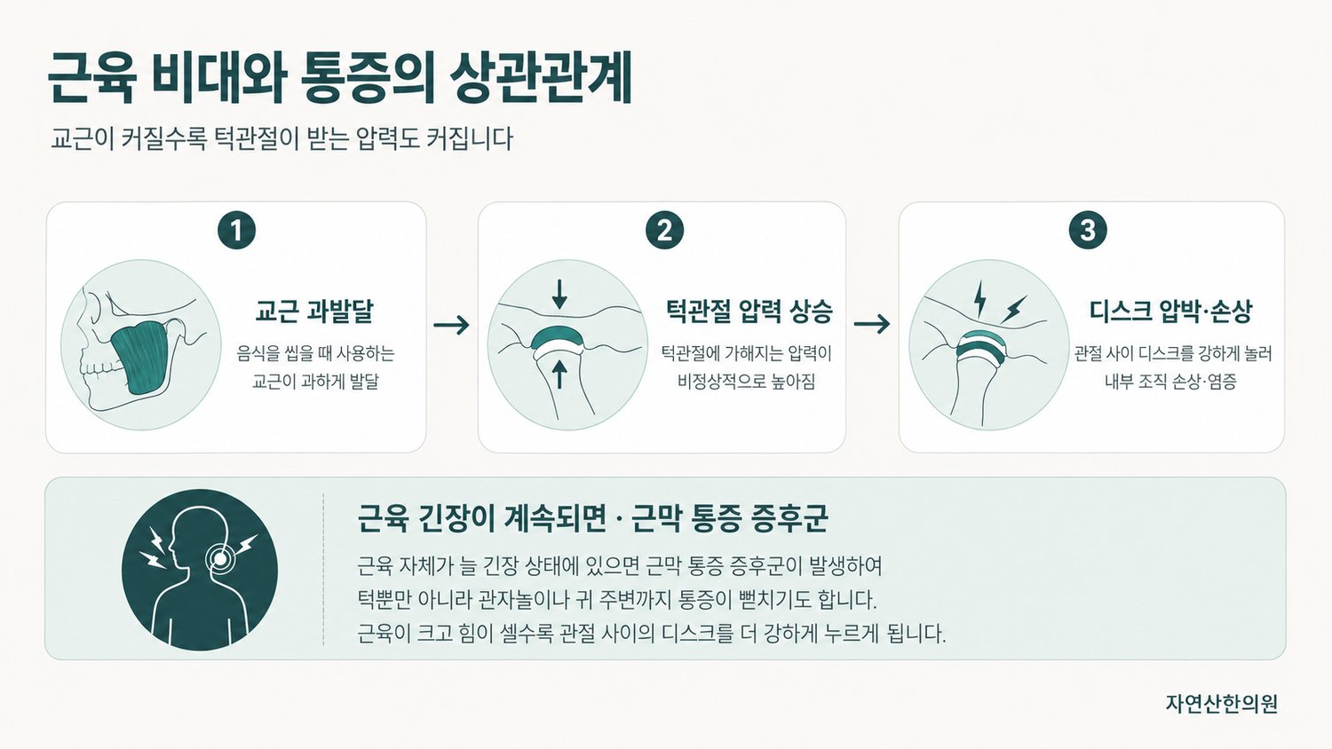 교근 과발달이 턱관절 압력 상승과 디스크 압박·손상으로 이어지는 경로 도해