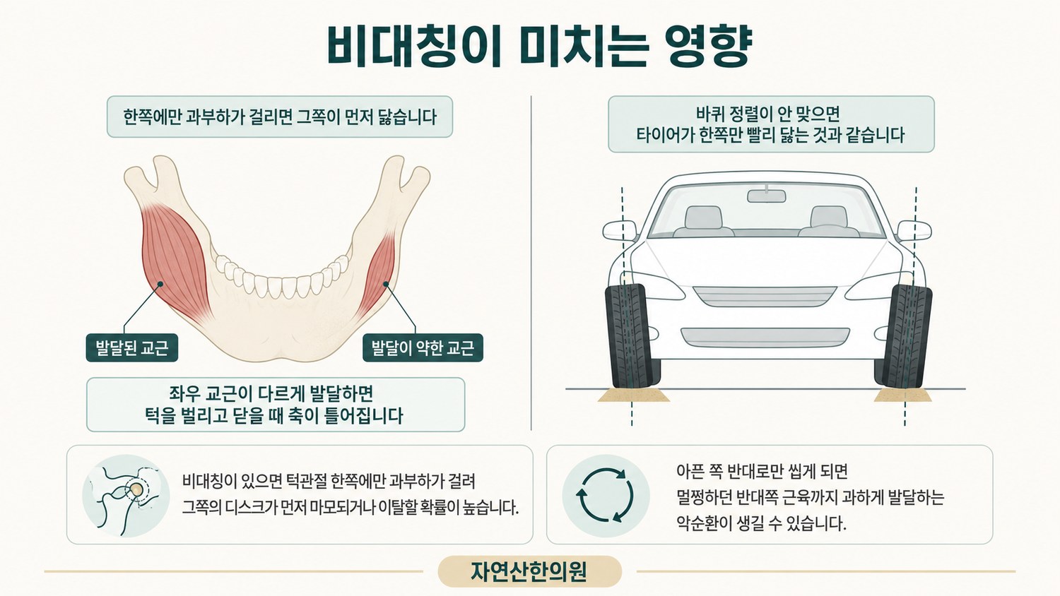 좌우 교근이 다르게 발달한 비대칭과 자동차 바퀴 정렬 비유를 나란히 놓은 도해