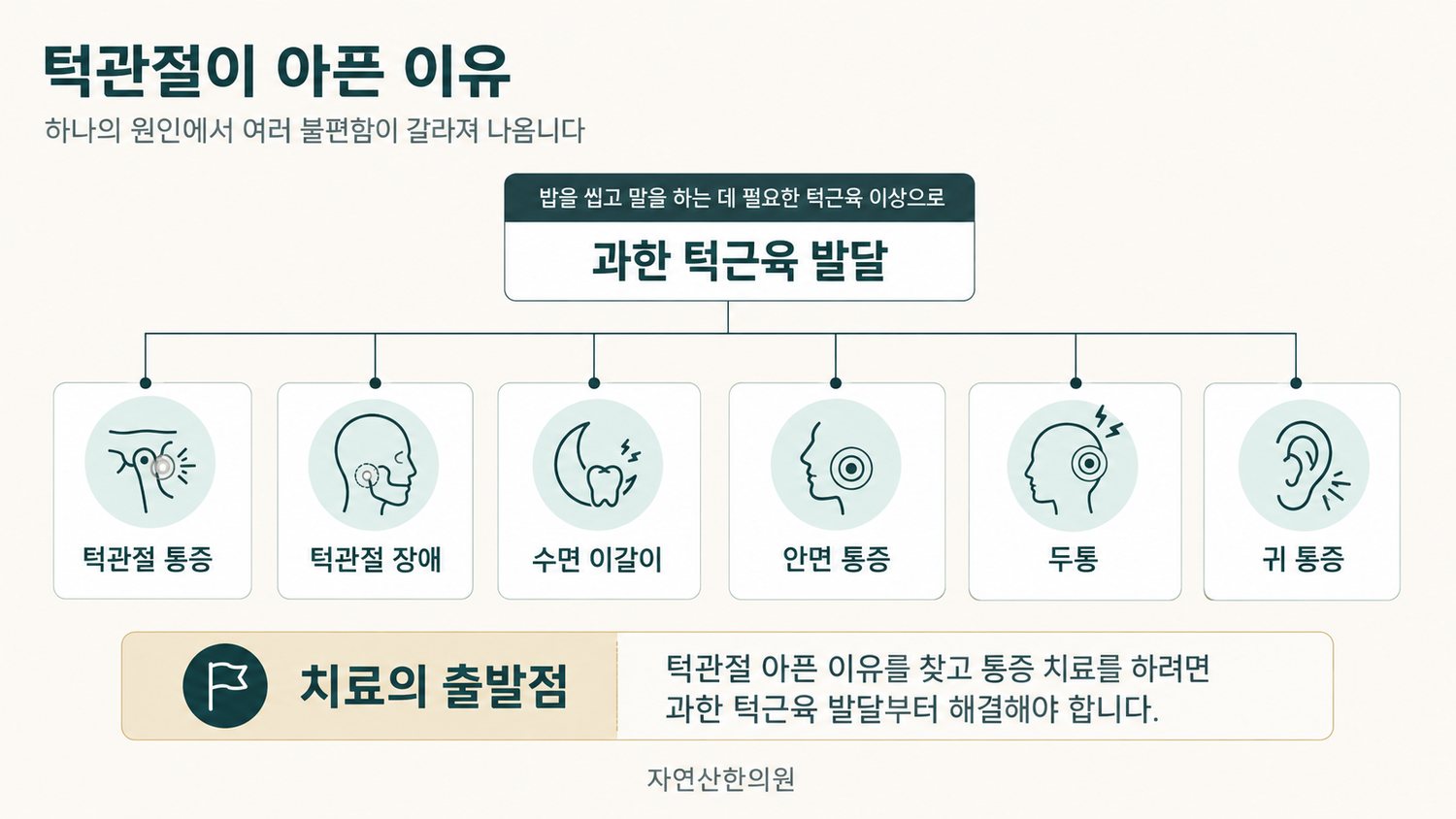 과한 턱근육 발달이 턱관절 통증, 턱관절 장애, 수면 이갈이, 안면 통증, 두통, 귀 통증으로 갈라지는 원인 트리 도해