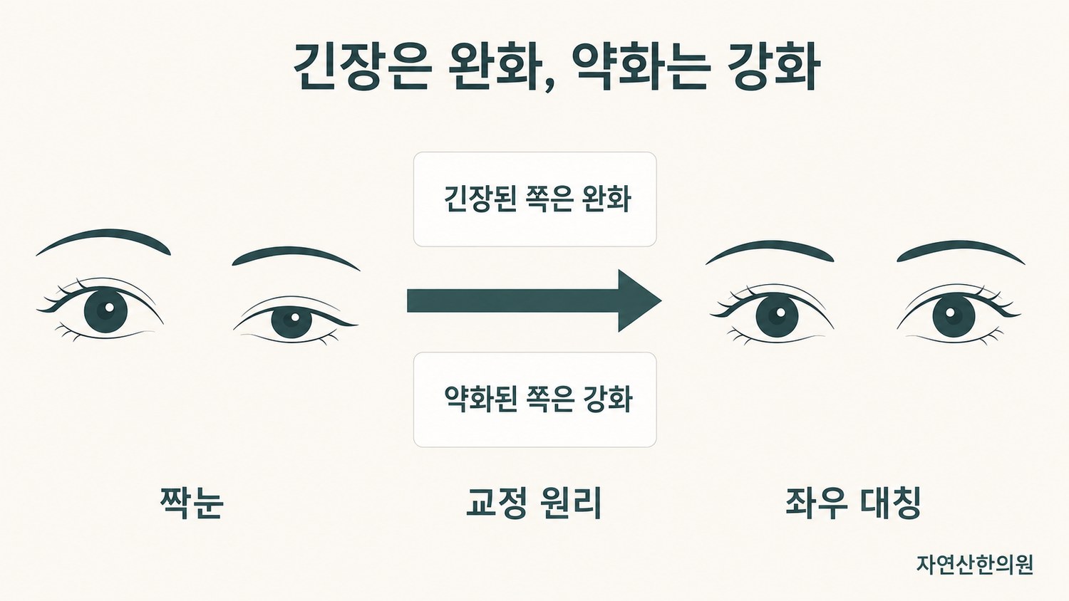 한쪽은 긴장, 다른 쪽은 약화된 좌우 패턴과 완화·강화를 통해 대칭으로 되돌아가는 과정을 표시한 개념 도해