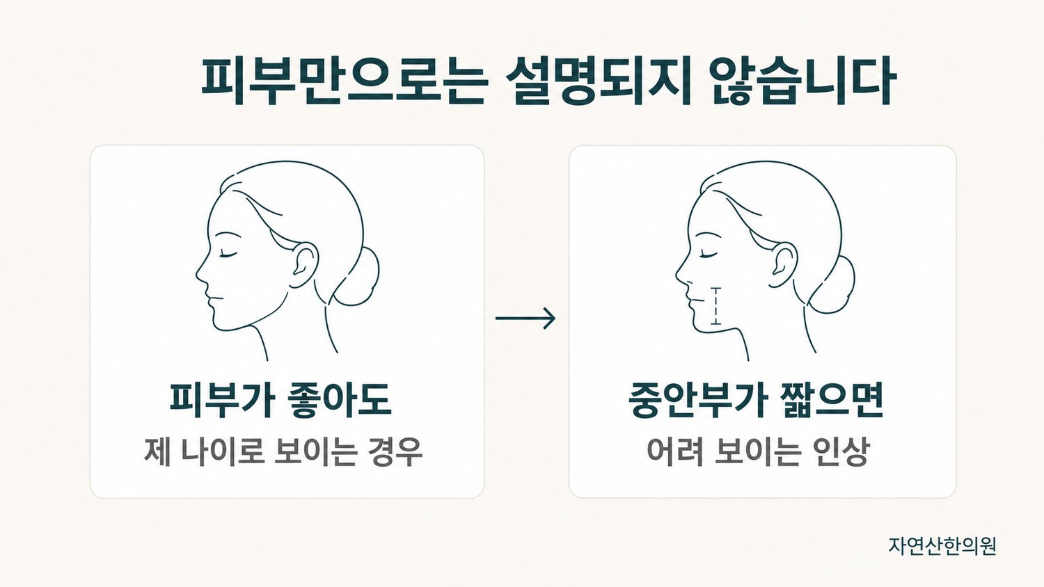 동일 인물의 피부 조건을 고정하고 중안부 길이만 다르게 한 두 얼굴 비교 도해