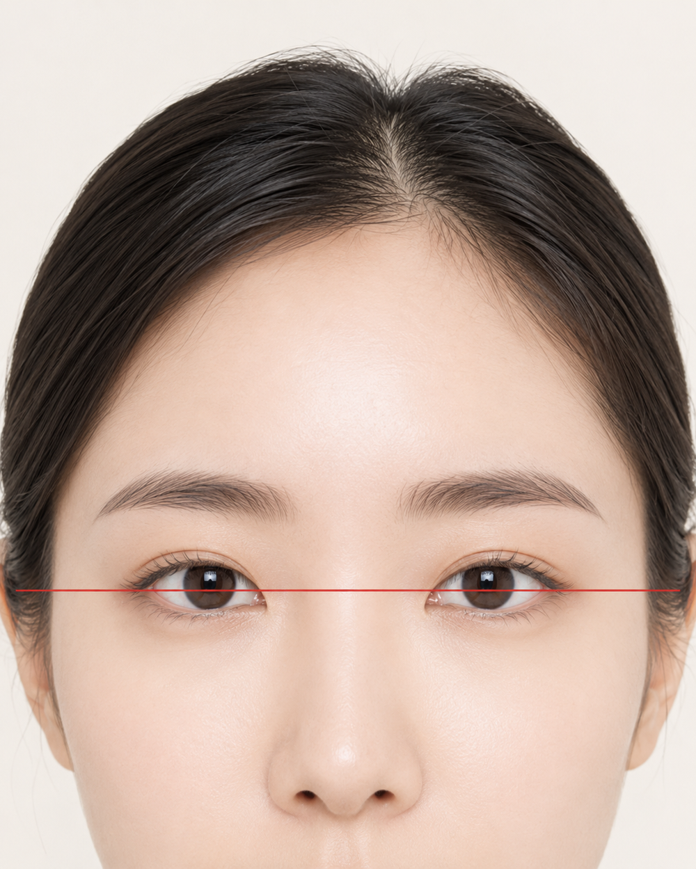 눈매 비대칭 진단 가이드